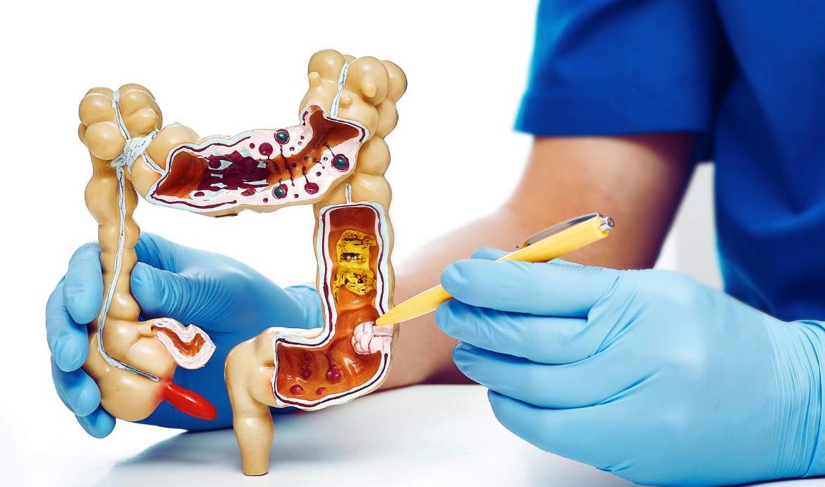 côlon et le rectum