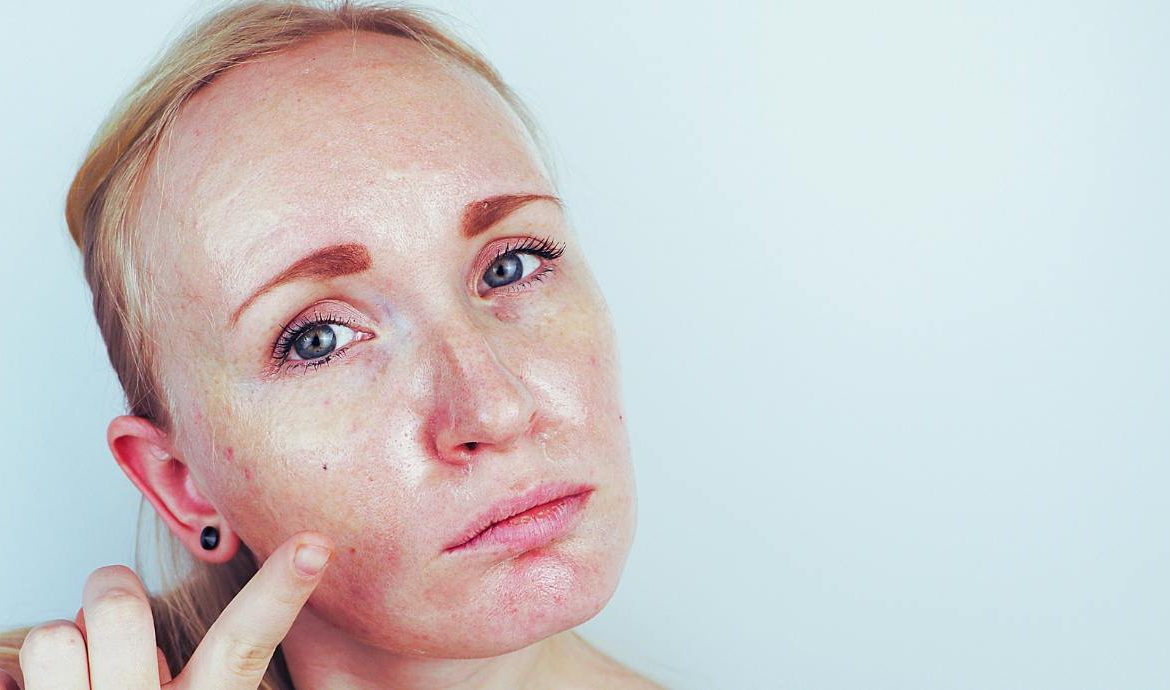 Visage d'une femme avec peau grasse