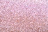 Zoom sur une peau séché et déshydraté