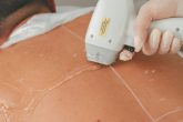 Praticien réalisant une épilation laser sur le dos d'un homme en cabinet